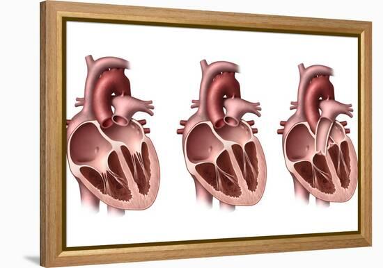 Heart Valves, Artwork-Henning Dalhoff-Framed Premier Image Canvas