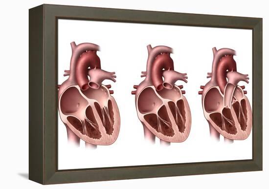 Heart Valves, Artwork-Henning Dalhoff-Framed Premier Image Canvas