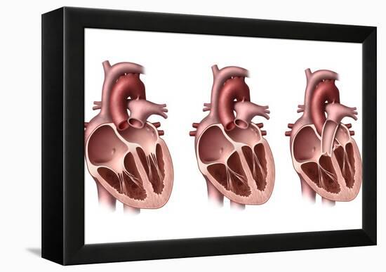 Heart Valves, Artwork-Henning Dalhoff-Framed Premier Image Canvas