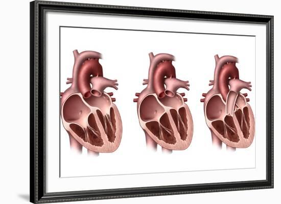 Heart Valves, Artwork-Henning Dalhoff-Framed Photographic Print