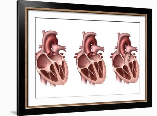 Heart Valves, Artwork-Henning Dalhoff-Framed Photographic Print