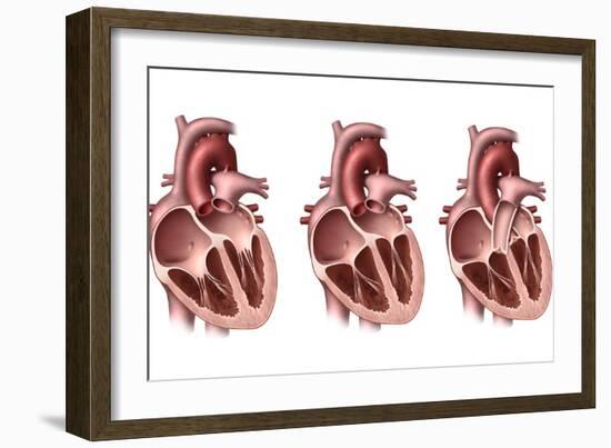 Heart Valves, Artwork-Henning Dalhoff-Framed Photographic Print