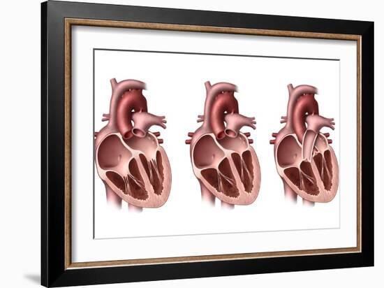 Heart Valves, Artwork-Henning Dalhoff-Framed Photographic Print