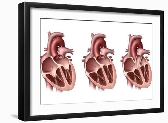 Heart Valves, Artwork-Henning Dalhoff-Framed Photographic Print
