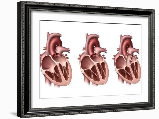 Heart Valves, Artwork-Henning Dalhoff-Framed Photographic Print