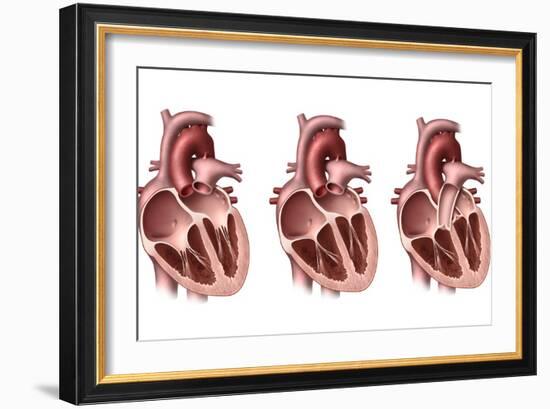 Heart Valves, Artwork-Henning Dalhoff-Framed Photographic Print