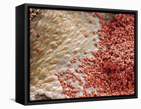 Heart Ventricle, SEM-Steve Gschmeissner-Framed Premier Image Canvas