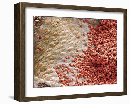 Heart Ventricle, SEM-Steve Gschmeissner-Framed Photographic Print