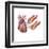 Heart with Arteries Showing Cholesterol in One and Plaque in the Other-null-Framed Art Print