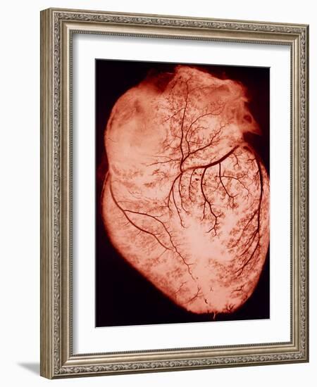 Heart with Arteries-Science Photo Library-Framed Photographic Print