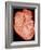 Heart with Arteries-Science Photo Library-Framed Photographic Print