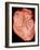 Heart with Arteries-Science Photo Library-Framed Photographic Print