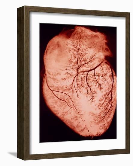 Heart with Arteries-Science Photo Library-Framed Photographic Print