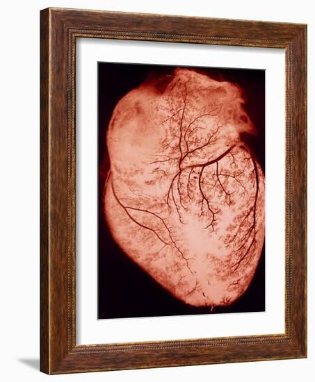 Heart with Arteries-Science Photo Library-Framed Photographic Print