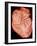 Heart with Arteries-Science Photo Library-Framed Photographic Print