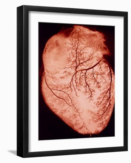 Heart with Arteries-Science Photo Library-Framed Photographic Print