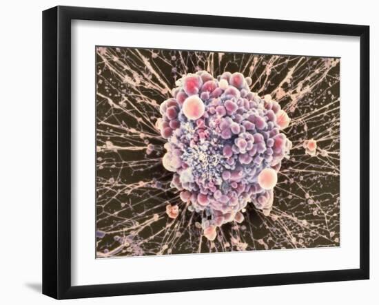 HeLa Cell Dying, SEM-Thomas Deerinck-Framed Photographic Print