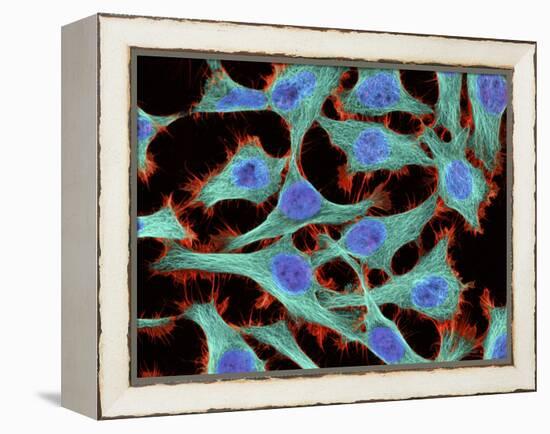 HeLa Cells, Light Micrograph-Thomas Deerinck-Framed Premier Image Canvas