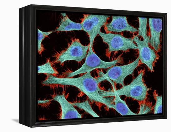 HeLa Cells, Light Micrograph-Thomas Deerinck-Framed Premier Image Canvas
