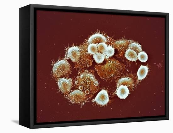 HeLa Cells, SEM-Science Photo Library-Framed Premier Image Canvas