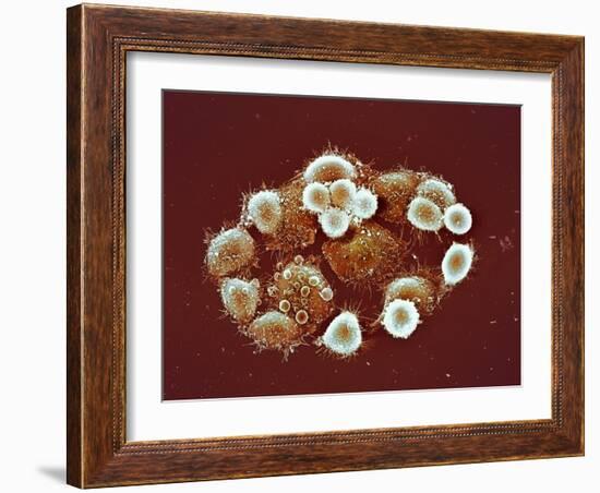 HeLa Cells, SEM-Science Photo Library-Framed Photographic Print