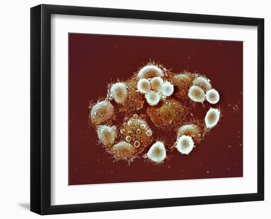 HeLa Cells, SEM-Science Photo Library-Framed Photographic Print