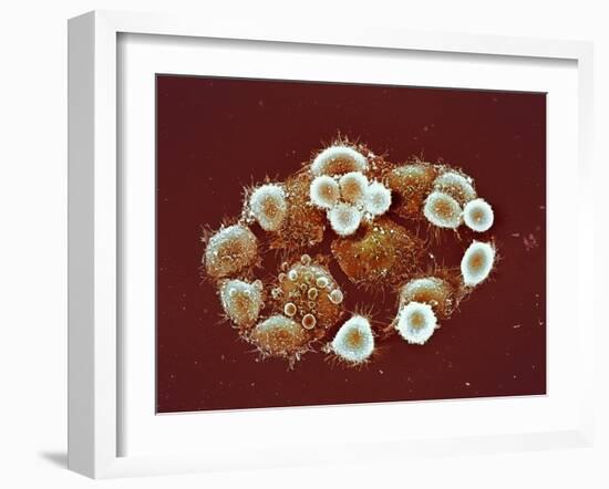 HeLa Cells, SEM-Science Photo Library-Framed Photographic Print