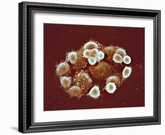 HeLa Cells, SEM-Science Photo Library-Framed Photographic Print