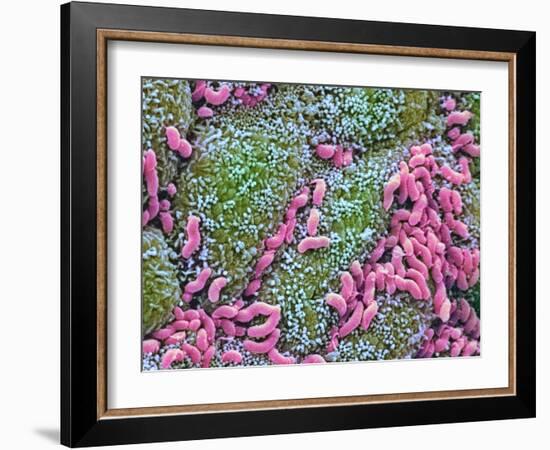 Helicobacter Pylori Bacteria In Stomach-null-Framed Photographic Print