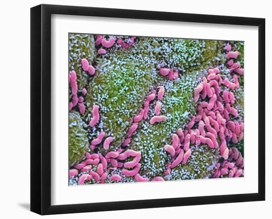 Helicobacter Pylori Bacteria In Stomach-null-Framed Photographic Print