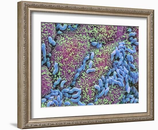 Helicobacter Pylori Bacteria In Stomach-null-Framed Photographic Print