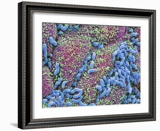 Helicobacter Pylori Bacteria In Stomach-null-Framed Photographic Print