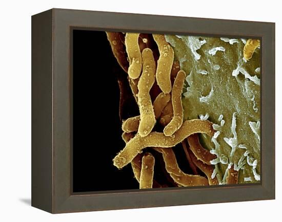 Helicobacter Pylori Bacteria, SEM-Science Photo Library-Framed Premier Image Canvas