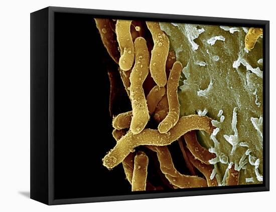 Helicobacter Pylori Bacteria, SEM-Science Photo Library-Framed Premier Image Canvas