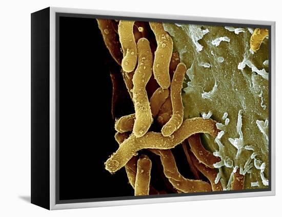 Helicobacter Pylori Bacteria, SEM-Science Photo Library-Framed Premier Image Canvas