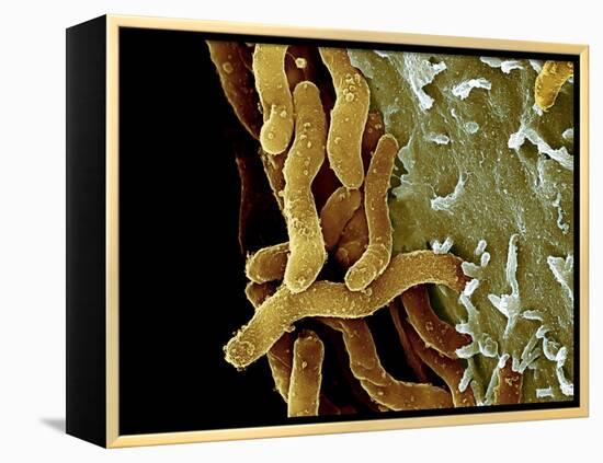 Helicobacter Pylori Bacteria, SEM-Science Photo Library-Framed Premier Image Canvas