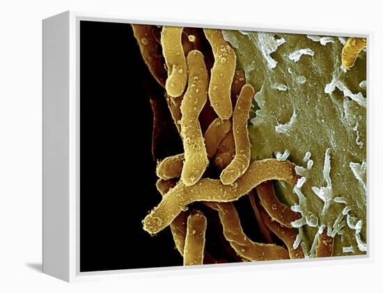 Helicobacter Pylori Bacteria, SEM-Science Photo Library-Framed Premier Image Canvas