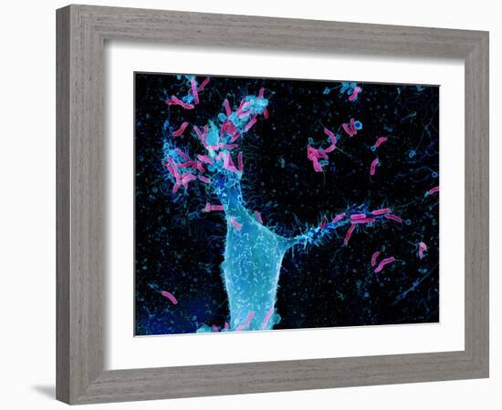 Helicobacter Pylori Bacteria, SEM-Science Photo Library-Framed Photographic Print