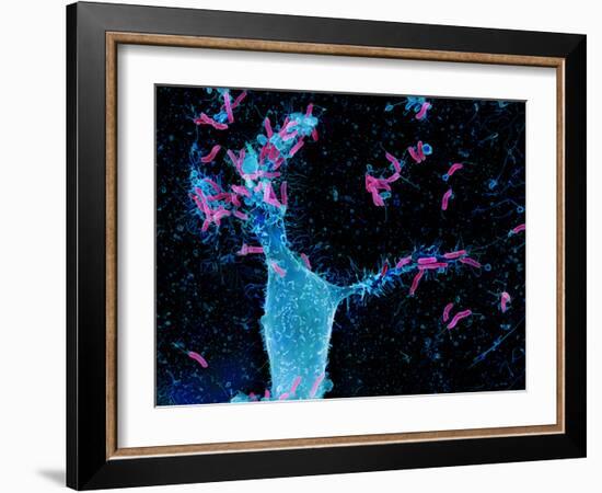 Helicobacter Pylori Bacteria, SEM-Science Photo Library-Framed Photographic Print