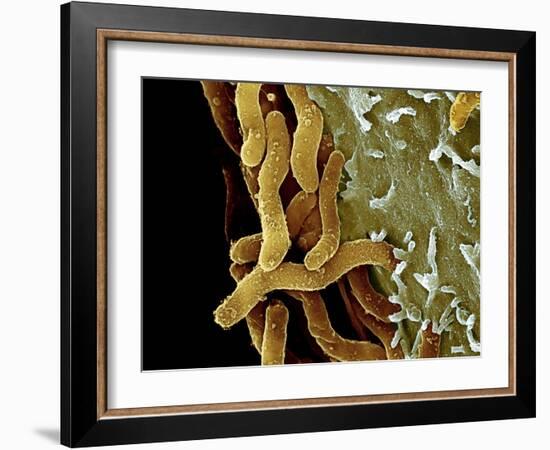 Helicobacter Pylori Bacteria, SEM-Science Photo Library-Framed Photographic Print