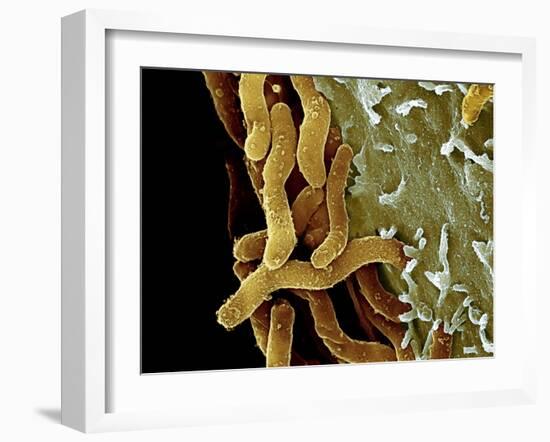 Helicobacter Pylori Bacteria, SEM-Science Photo Library-Framed Photographic Print