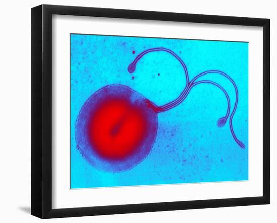 Helicobacter Pylori Bacterium, TEM-Biomedical Imaging-Framed Photographic Print