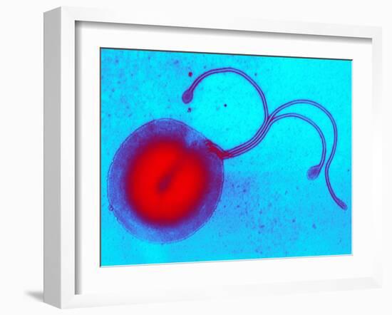 Helicobacter Pylori Bacterium, TEM-Biomedical Imaging-Framed Photographic Print