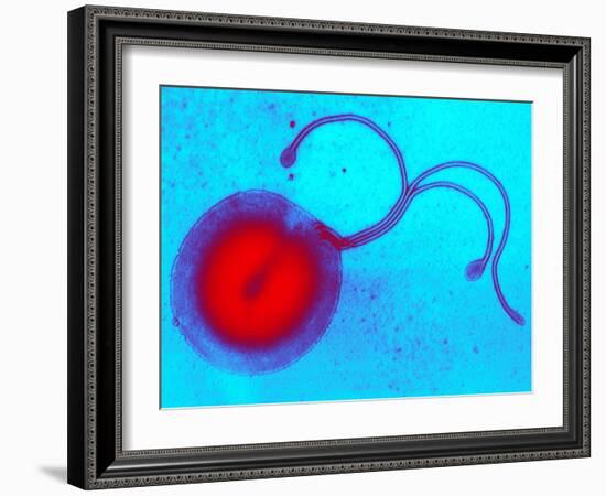 Helicobacter Pylori Bacterium, TEM-Biomedical Imaging-Framed Photographic Print