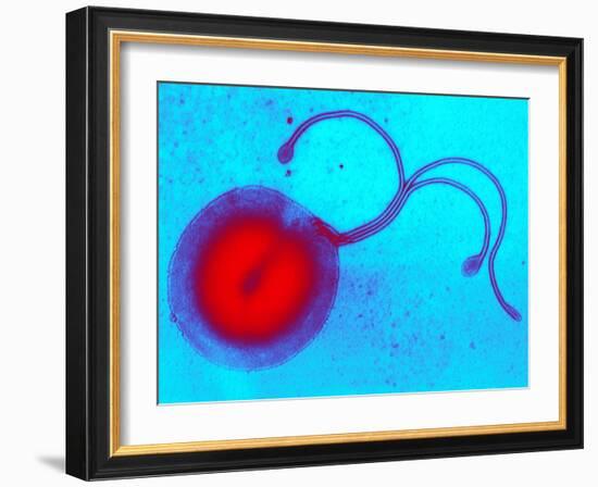 Helicobacter Pylori Bacterium, TEM-Biomedical Imaging-Framed Photographic Print