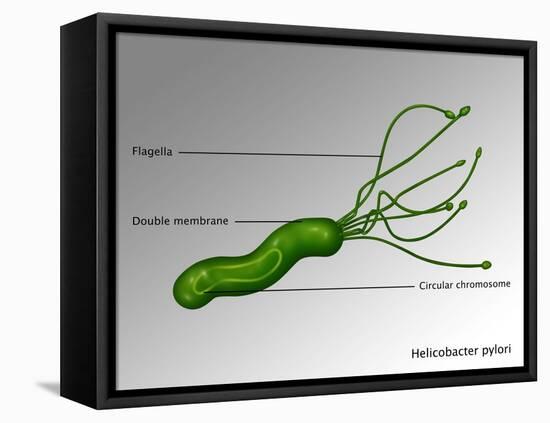 Helicobacter Pylori, Illustration-Gwen Shockey-Framed Premier Image Canvas