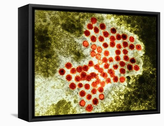 Hepatitis a Virus Particles, TEM-Hazel Appleton-Framed Premier Image Canvas