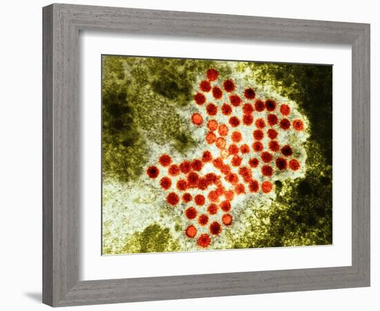 Hepatitis a Virus Particles, TEM-Hazel Appleton-Framed Photographic Print