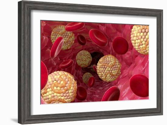 High Cholesterol Levels, Artwork-David Mack-Framed Photographic Print