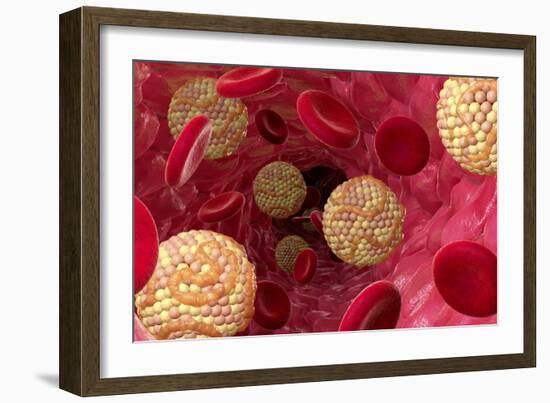 High Cholesterol Levels, Artwork-David Mack-Framed Photographic Print